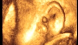 Primi gravida di 31 anni…..