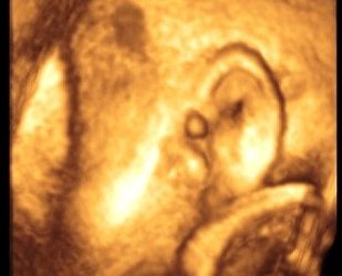 Primi gravida di 31 anni…..