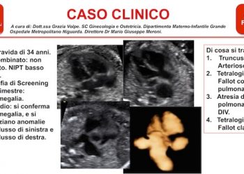 Caso del Mese di Febbraio 2020