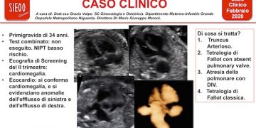 Caso del Mese di Febbraio 2020