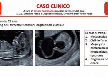 Caso del Mese di Marzo 2020