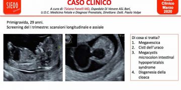 Caso del Mese di Marzo 2020
