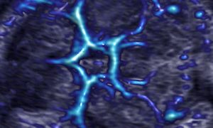 How To Do Marzo 2020