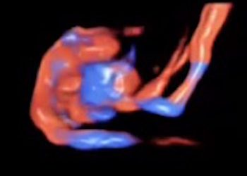 How To Do Maggio 2020: il dotto venoso