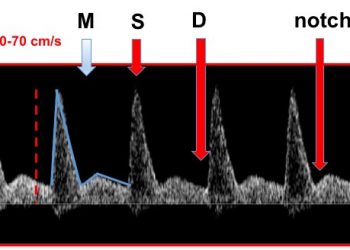 How To Do Giugno 2020: le arterie uterine