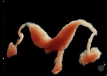 How To Do Luglio 2020: isterosalpingosonografia