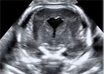 Casi del Mese di Agosto 2020