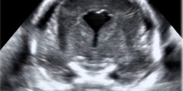 Casi del Mese di Agosto 2020