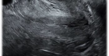 How To Do Settembre 2020: La Cervicometria