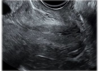 How To Do Settembre 2020: La Cervicometria