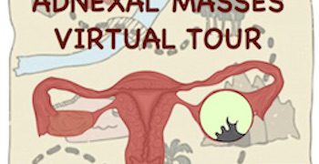 Adnexal Masses Virtual Tour – 1a Tappa