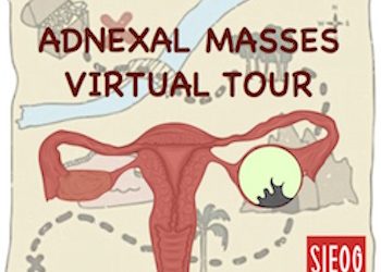 Adnexal Masses Virtual Tour – 1a Tappa