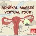 Adnexal Masses Virtual Tour – 1a Tappa