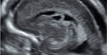 Caso del Mese di Ottobre 2020