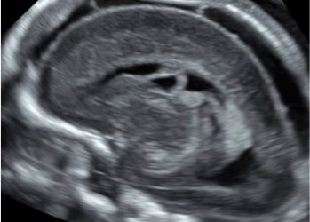 Caso del Mese di Ottobre 2020