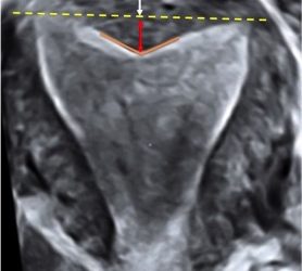 How To Do Ottobre 2020: Le Malformazioni Uterine