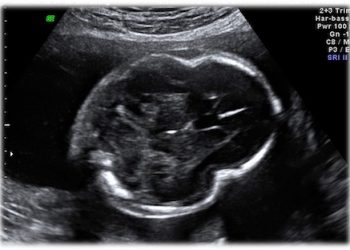 Caso del Mese di Novembre 2020