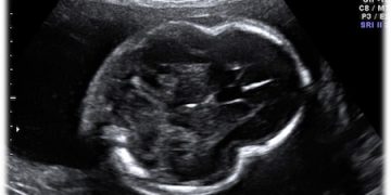 Caso del Mese di Novembre 2020