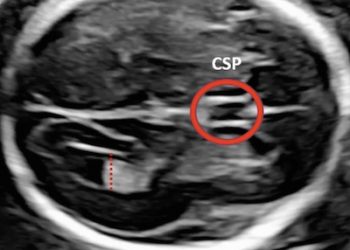 How To Do Novembre 2020: Approccio Base all’Encefalo Fetale