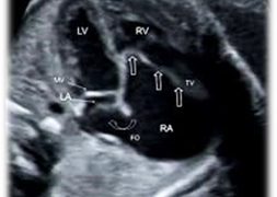 Casi del Mese di Dicembre 2020