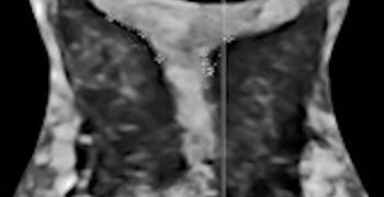 Journal Club Dicembre 2020