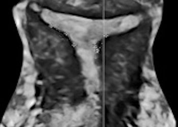 Journal Club Dicembre 2020