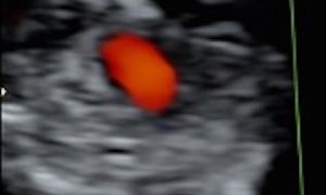 Casi del Mese di Gennaio 2021