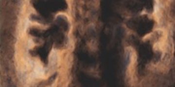 Journal Club Gennaio 2021