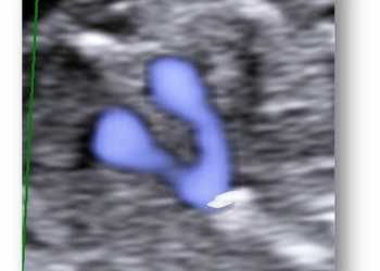 Caso del Mese di Febbraio 2021