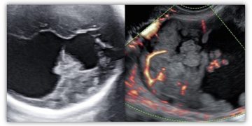 Casi del Mese di Marzo 2021