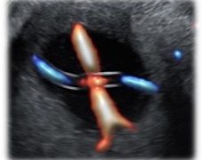 Caso del Mese di Aprile 2021