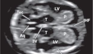 Journal Club Maggio 2021