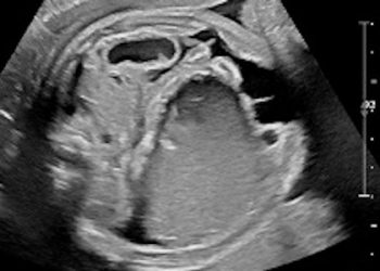 Caso del Mese di Giugno 2021