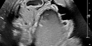 Caso del Mese di Giugno 2021
