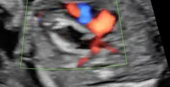 Caso del Mese di Luglio 2021