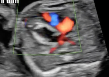 Caso del Mese di Luglio 2021