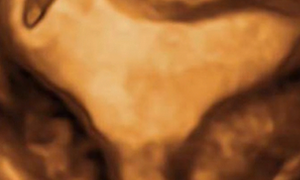 How To Do Luglio 2021: La Gravidanza Ectopica