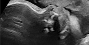 Caso del Mese di Agosto 2021