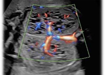 Caso del Mese di Settembre 2021