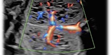 Caso del Mese di Settembre 2021