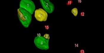 How To Do Settembre 2021: Conta dei Follicoli Antrali