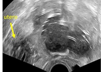 Caso del Mese di Ottobre 2021