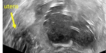 Caso del Mese di Ottobre 2021