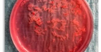 How To Do Ottobre 2021: Villocentesi