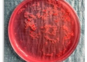 How To Do Ottobre 2021: Villocentesi