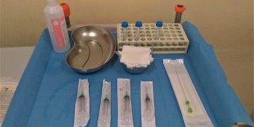 How To Do Novembre 2021: Amniocentesi