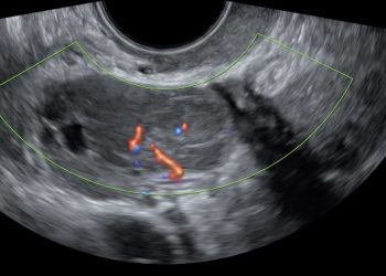 Caso del Mese di Dicembre 2021