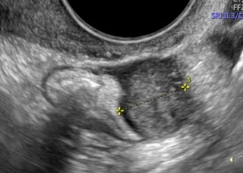 Casi del Mese di Gennaio 2022