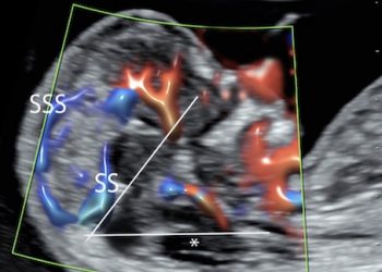 How To Do Gennaio 2022: neurosonografia fetale precoce
