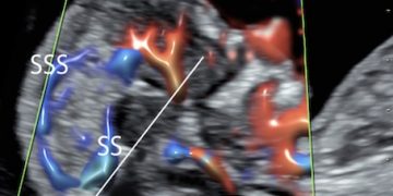 How To Do Gennaio 2022: neurosonografia fetale precoce